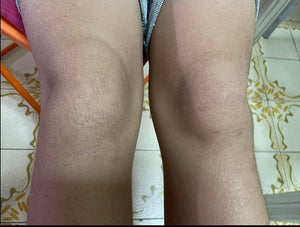 After 20 Days (Legs)